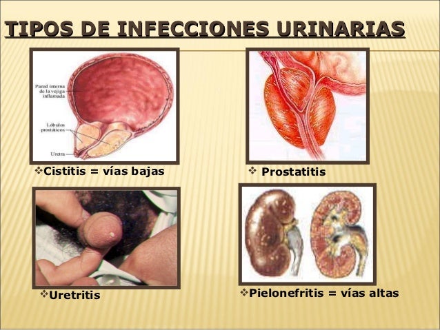 Old treatment for sinus pressure sinus headache medication over-the-counter